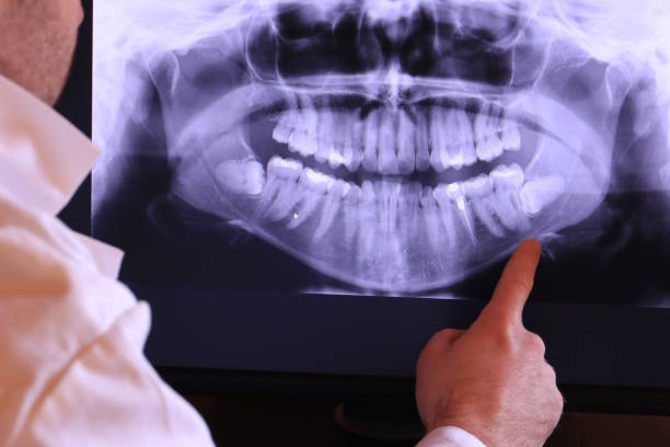 Best Broken or Cracked Tooth Emergency Dentist in Mckee City, NJ